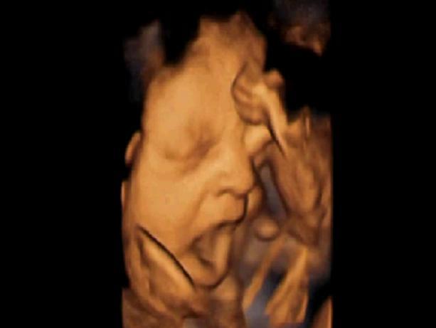 Imagini ULUITOARE: Un fetus cască şi se freacă la ochi în pântecele mamei lui (VIDEO)