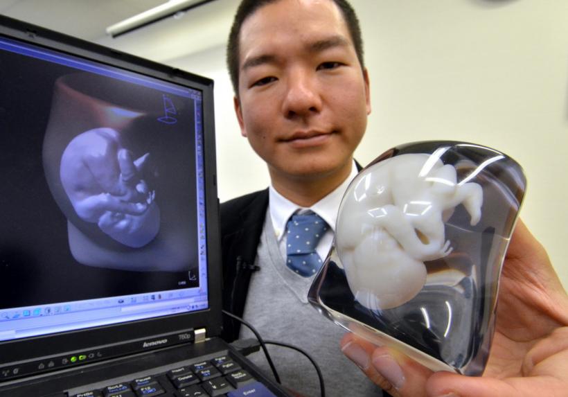Cum poţi avea un model 3D al bebeluşului tău nenăscut