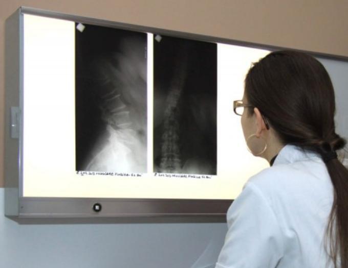 Radiografie ŞOCANTĂ! Medicii au rămas FĂRĂ CUVINTE după ce au văzut asta