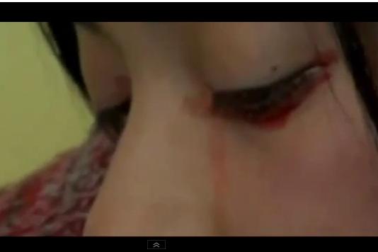 Medicii nu au putere în faţa acestei boli: o tânără plânge cu lacrimi de...sânge! (VIDEO)