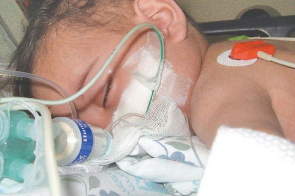 Pneumonia ucide anual, în lume, peste un milion de copii