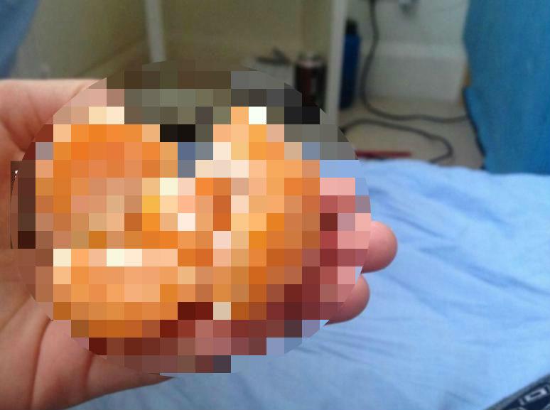 Fotografia care a devenit VIRALĂ pe Internet. Ce a descoperit un bărbat într-o portocală (FOTO) 