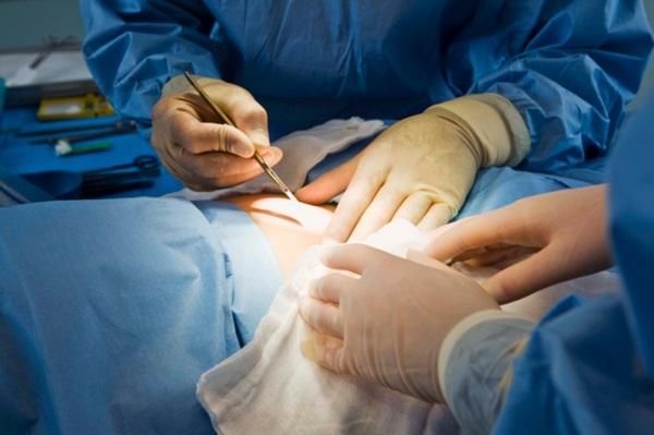 Operația de cezariană la cerere nu e inclusă în pachetul de servicii medicale de bază 