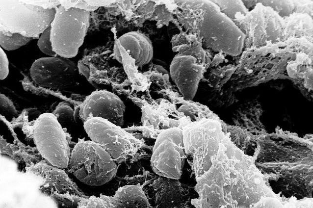 Genomul bacteriei care a provocat cele mai grave pandemii din istorie, reconstituit în laborator