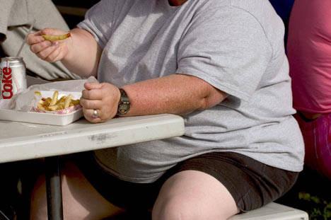 Dezbatere pe tema obezităţii, la Parlament. Un român din patru suferă de obezitate