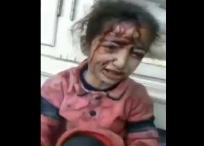 O fetiţă siriană rănită într-un bombardament: &quot;S-a întâmplat pentru că astăzi am fost fericiţi?&quot; (VIDEO)