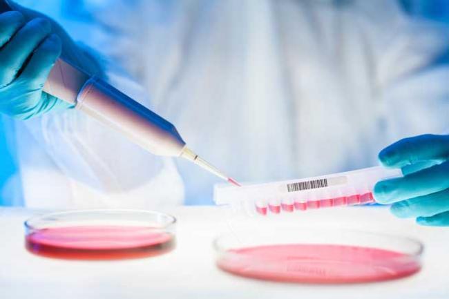Test de urină pentru depistarea cancerului colorectal