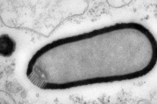 Virus inactiv vreme de 30.000 de ani, redeşteptat în Siberia. &quot;Este o reţetă pentru dezastru&quot;
