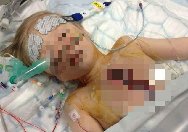 CAZ INCREDIBIL în Marea Britanie: Băieţel de 3 ani, operat pe inimă şi lăsat cu pieptul deschis, timp de 5 zile! (VIDEO)
