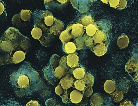 OMS: Rezistenţa bacteriilor la antibiotice, &quot;o ameninţare globală majoră&quot;