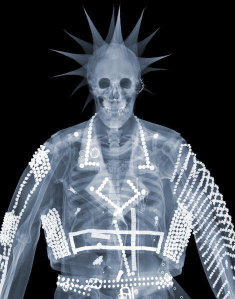 Radiografiile care au devenit artă: Colecţie inedită realizată de aparatele cu raze X