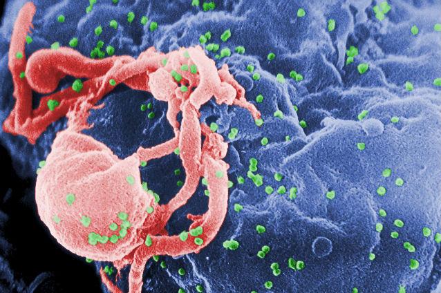 Unde, cum şi când a apărut prima dată virusul HIV: A fost o &quot;furtună perfectă&quot; de factori