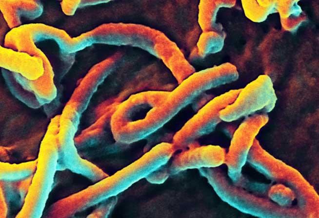 Ebola, cine nu moare se vindecă!?