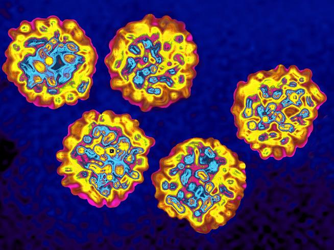 Virusul hepatitic C, scos din circulaţie. Cu un program naţional şi  cu noile molecule, e posibilă reducerea numărului cazurilor de ciroză şi cancer hepatic