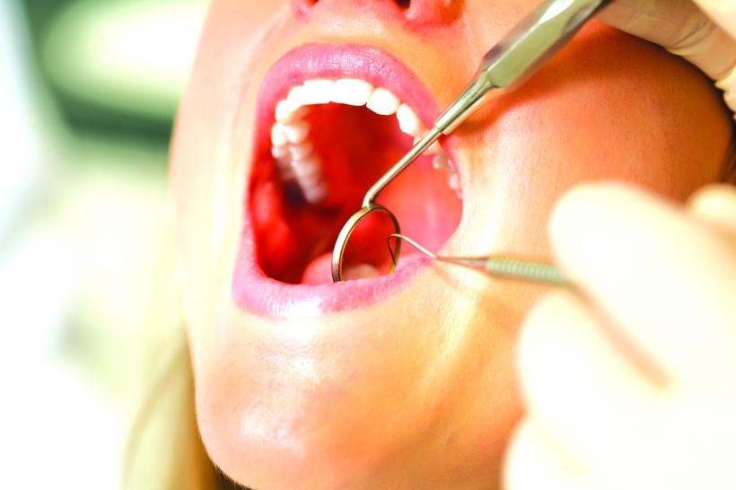 Implantul dentar, mituri explicate de un specialist