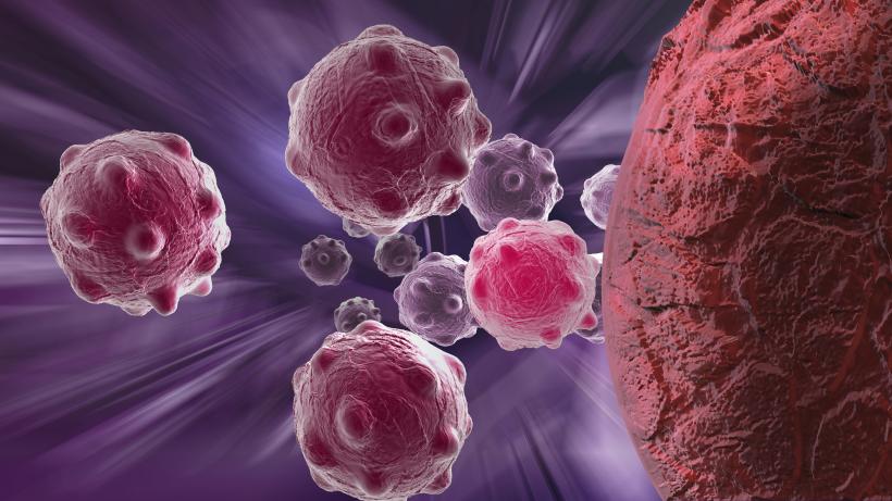 Medicamentele beta-blocante pot îmbunătăți rata de supraviețuire a femeilor bolnave de cancer ovarian