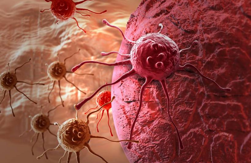 7 simptome ale cancerului de col uterin de care femeile ar trebui să țină cont