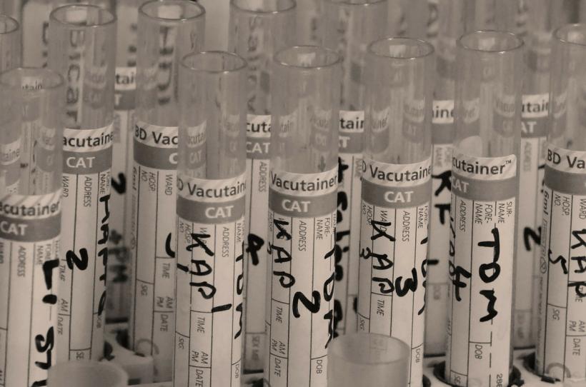 Românii se pot testa gratuit pentru HIV şi virusurile hepatice B şi C 