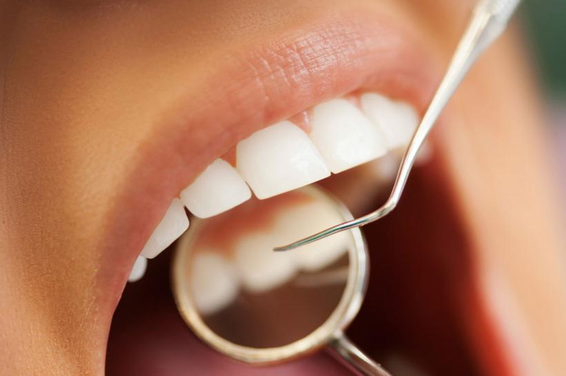 Uitați de mituri! Albirea dentară nu strică dinții