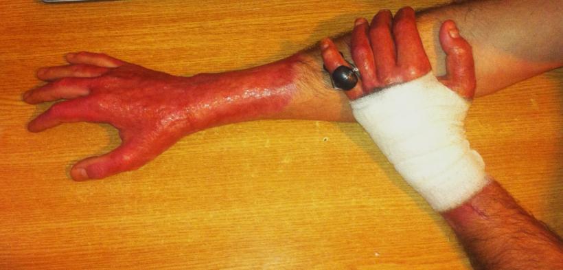 Imagini șocante postate de un rănit în tragedia din Colectiv 18524771