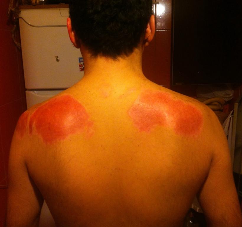 Imagini șocante postate de un rănit în tragedia din Colectiv 18524772