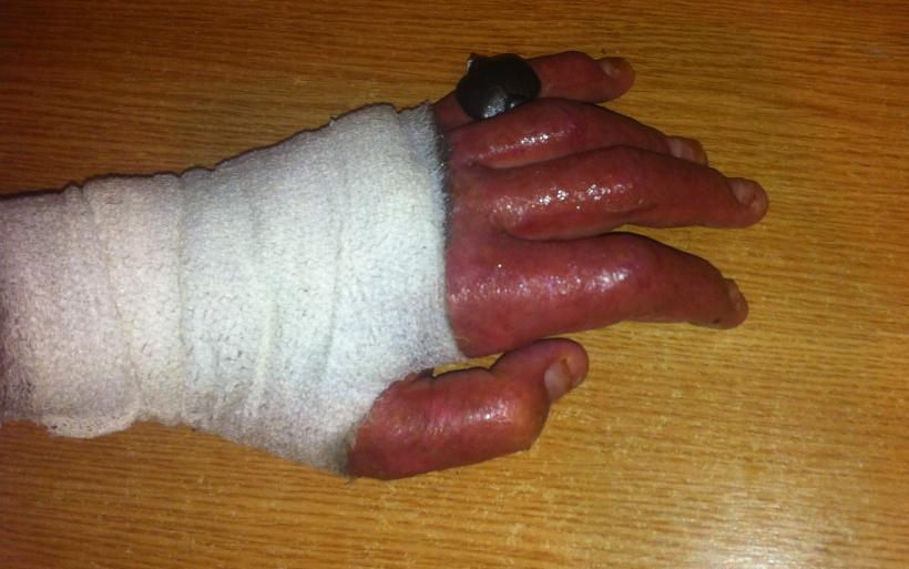 Imagini șocante postate de un rănit în tragedia din Colectiv 18524773