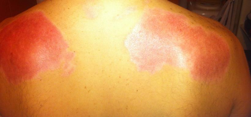 Imagini șocante postate de un rănit în tragedia din Colectiv 18524774