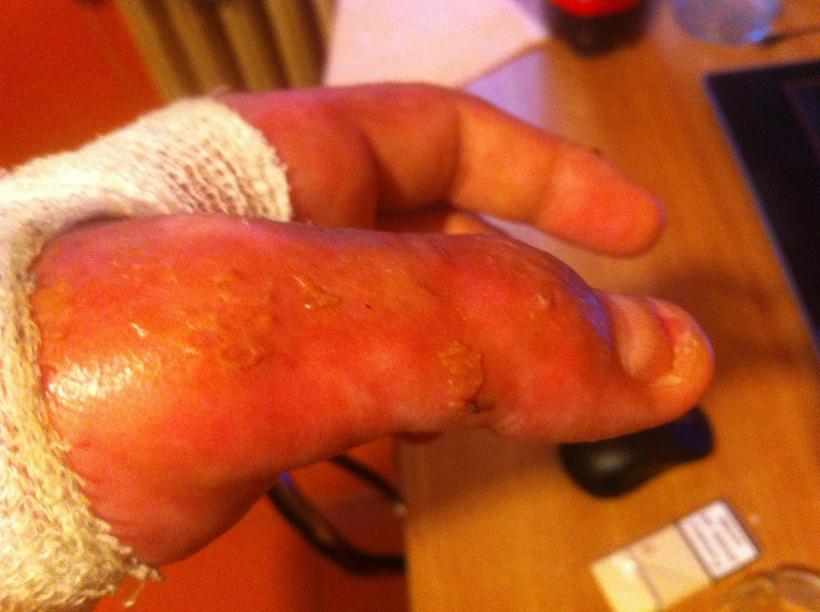 Imagini șocante postate de un rănit în tragedia din Colectiv 18524776