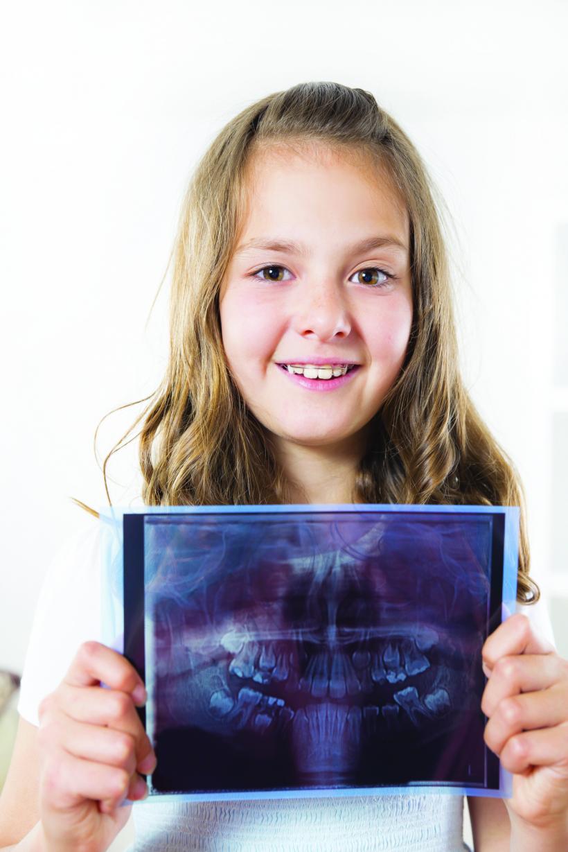 Ortodont: Dinții înghesuiți sunt primii care se strică