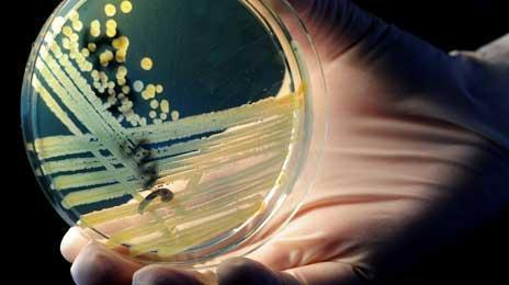 Bacteria E.coli, depistată de inspectorii sanitar-veterinari în laptele provenit de la o fermă de bovine din Alba