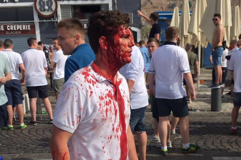 EURO 2016 - Cel puţin 35 de răniţi după incidentele de la Marsilia 