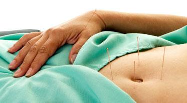 Tratamente naturiste. Tratarea infertilității de cuplu prin acupunctură și fitoterapie