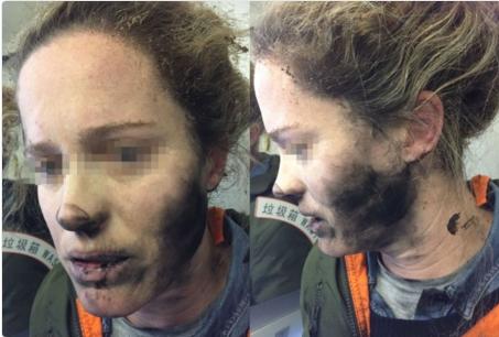 O australiancă a suferit arsuri pe faţă după ce căştile i-au explodat în timpul unui zbor