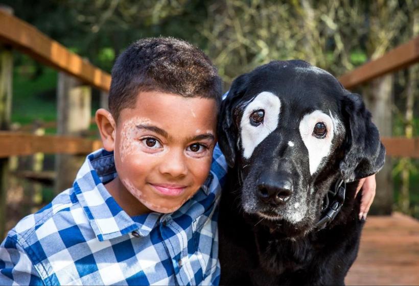 Un băiat de 8 ani cu o boală de piele rară a cunoscut un câine care suferă de aceeaşi afecţiune
