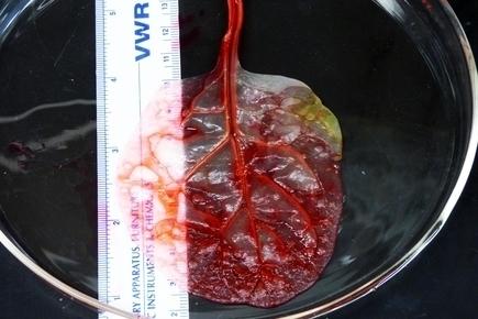 Incredibil! O frunză de spanac, transformată în țesut uman, poate salva numeroase vieți