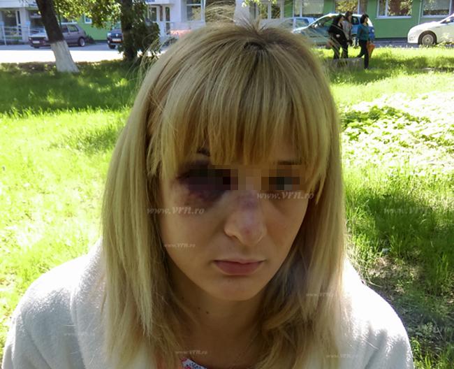 O tânără din Costești, la un pas de a fi ucisă de fostul soț. Bărbatul este încă în libertate
