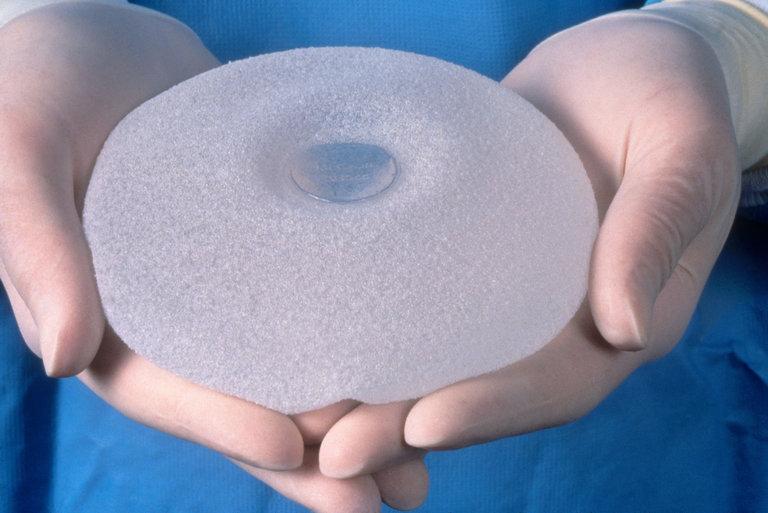 În ce condiții implanturile mamare îți pot salva viața
