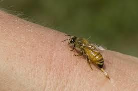 Alertă în Harghita! Numărul cazurilor de înţepături de viespi şi albine a crescut semnificativ.Unii pacienți vin în șoc anafilactic la spital