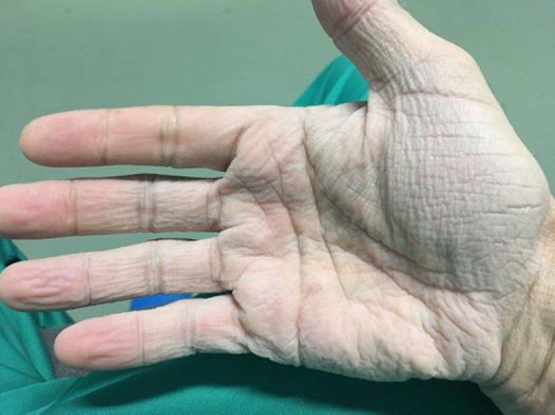 Mesajul unui chirurg dintr-un spital din România a revoltat întreaga Românie: „Mâna dreaptă, după 12 ore de operații la 30 de grade...”