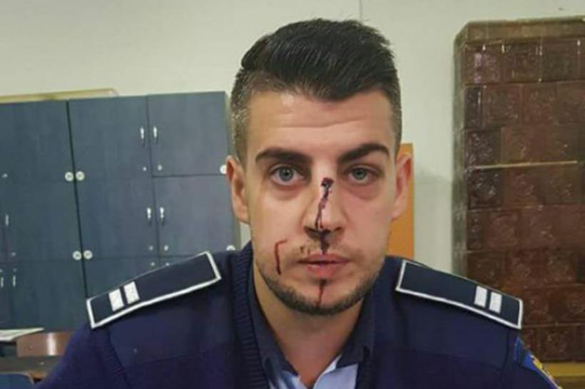 Un polițist s-a ales nu nasul spart după ce a fost bătut de un șofer beat