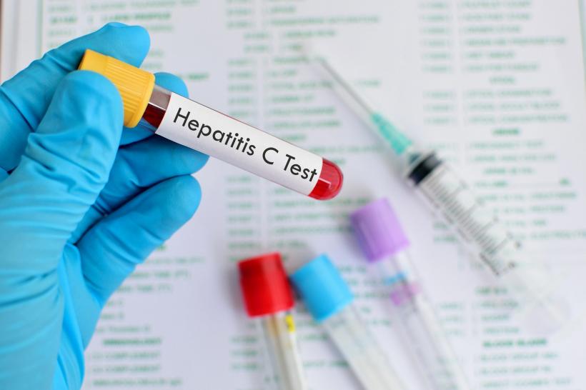 Problemele românilor cu hepatite, dezbătute în PE