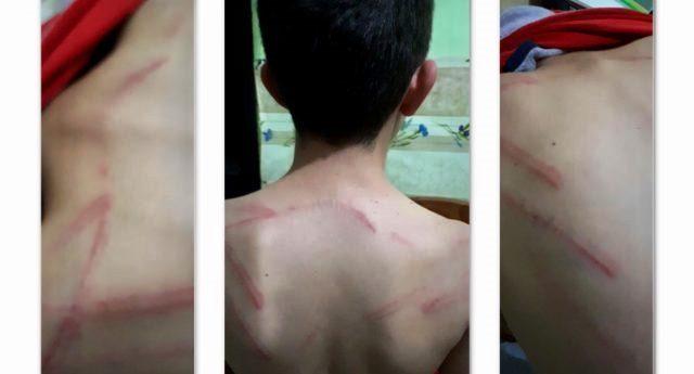 Copil de 9 ani, bătut cu cruzime de tatăl său, aflat în stare de ebrietate