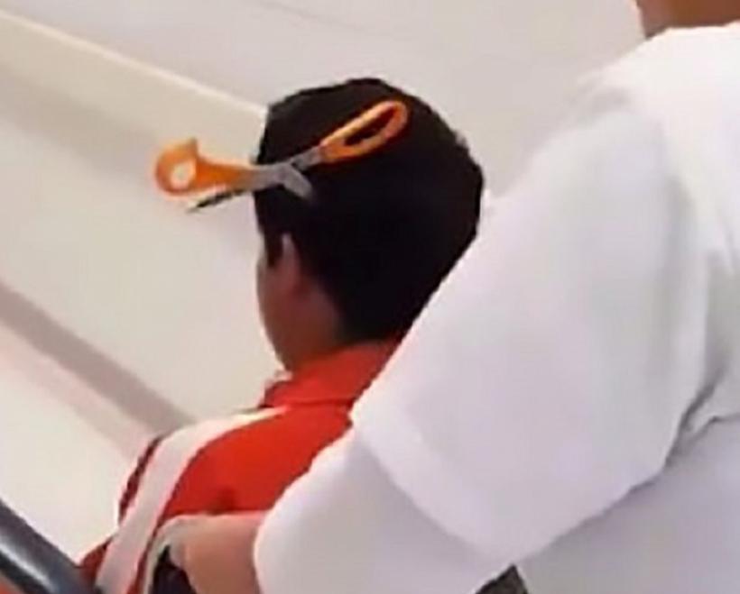 Șocant! Un adolescent a ajuns la spital cu o foarfecă  înfiptă în cap, după o dispută cu o colegă de clasă