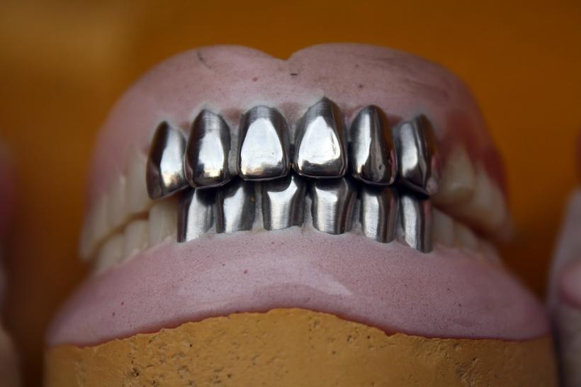România știrbă: peste un sfert din populație nu mai are niciun dinte în gură