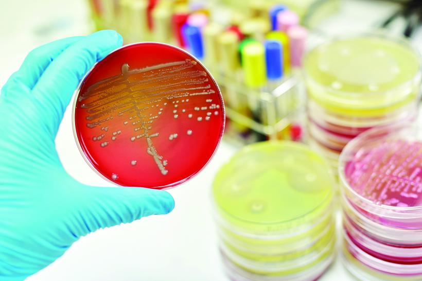 Antibiotice descoperite în sol, leac pentru „super-bacterii”