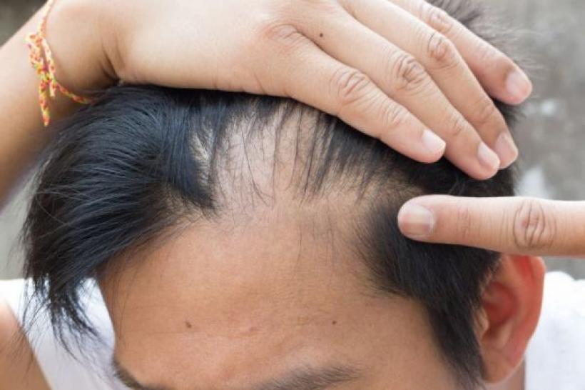 Căderea părului: Mituri și greșeli care te lasă fără păr
