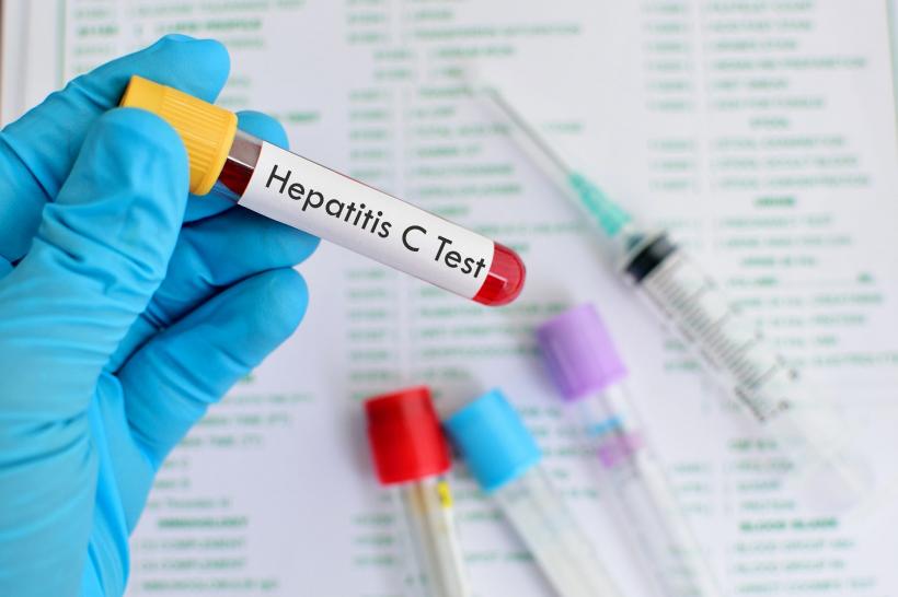 Analize gratuite pentru hepatită, din aprilie