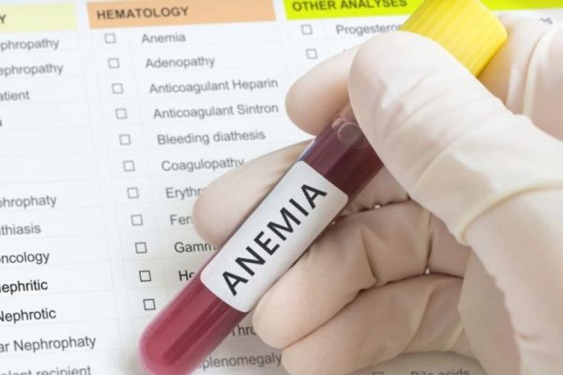Simptomele anemiei și alimentele care ne ajută să scăpăm de ea