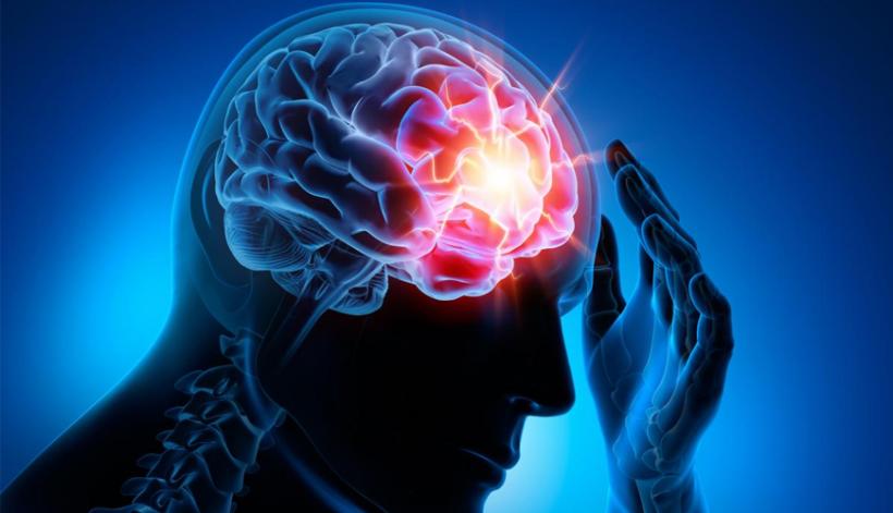 Epilepsia, o descărcare furtunoasă de electricitate în creier pe căi nefireşti