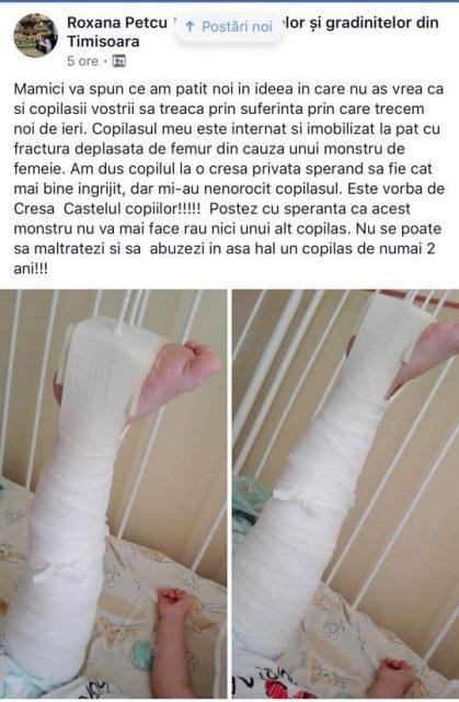 Timișoara - Un copil de doi ani a ajuns la spital cu fractură de femur după ce ar fi fost agresat la grădiniță
